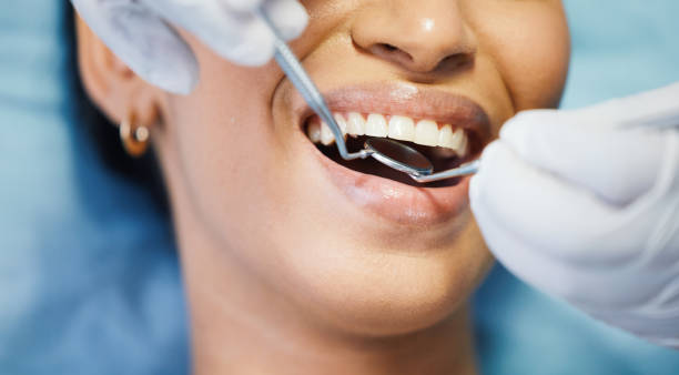Best Urgent Care for Lost Fillings or Crowns in Seminole Manor, FL